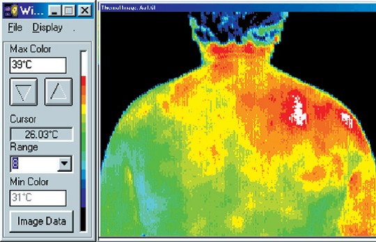 digital thermal infrared imaging scan