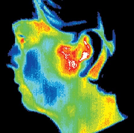 digital thermal infrared imaging