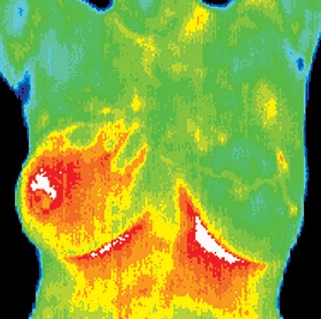 digital thermal infrared imaging