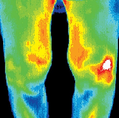 digital thermal infrared imaging