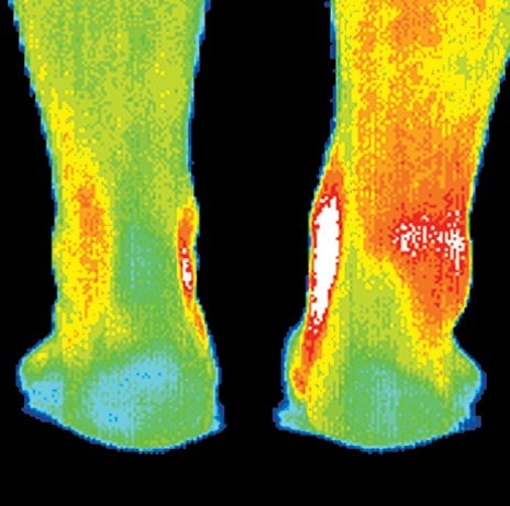 digital thermal infrared imaging