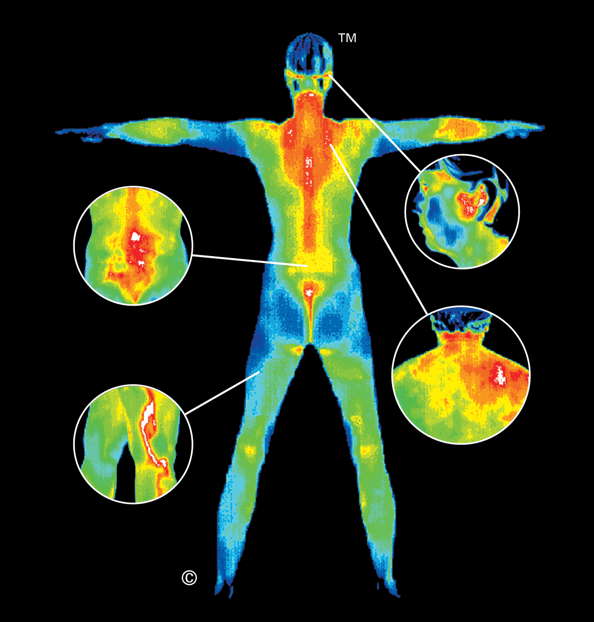 digital thermal infrared imaging